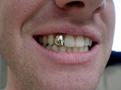 Σέρρες: Πωλούν ακόμα και τα χρυσά τους δόντια για τα βγάλουν πέρα