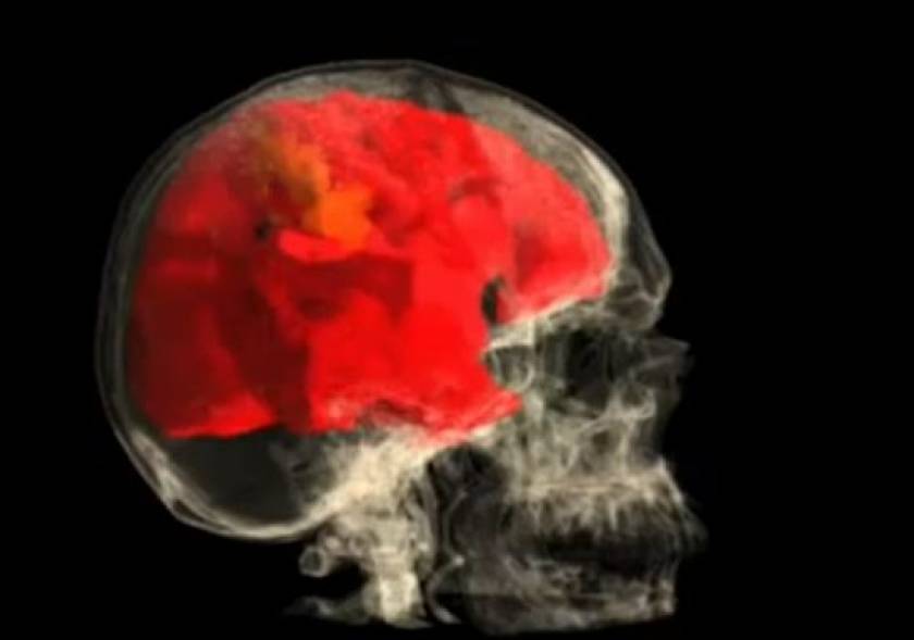 Video: Πυροτέχνημα ο γυναικείος εγκέφαλος κατά τον οργασμό!