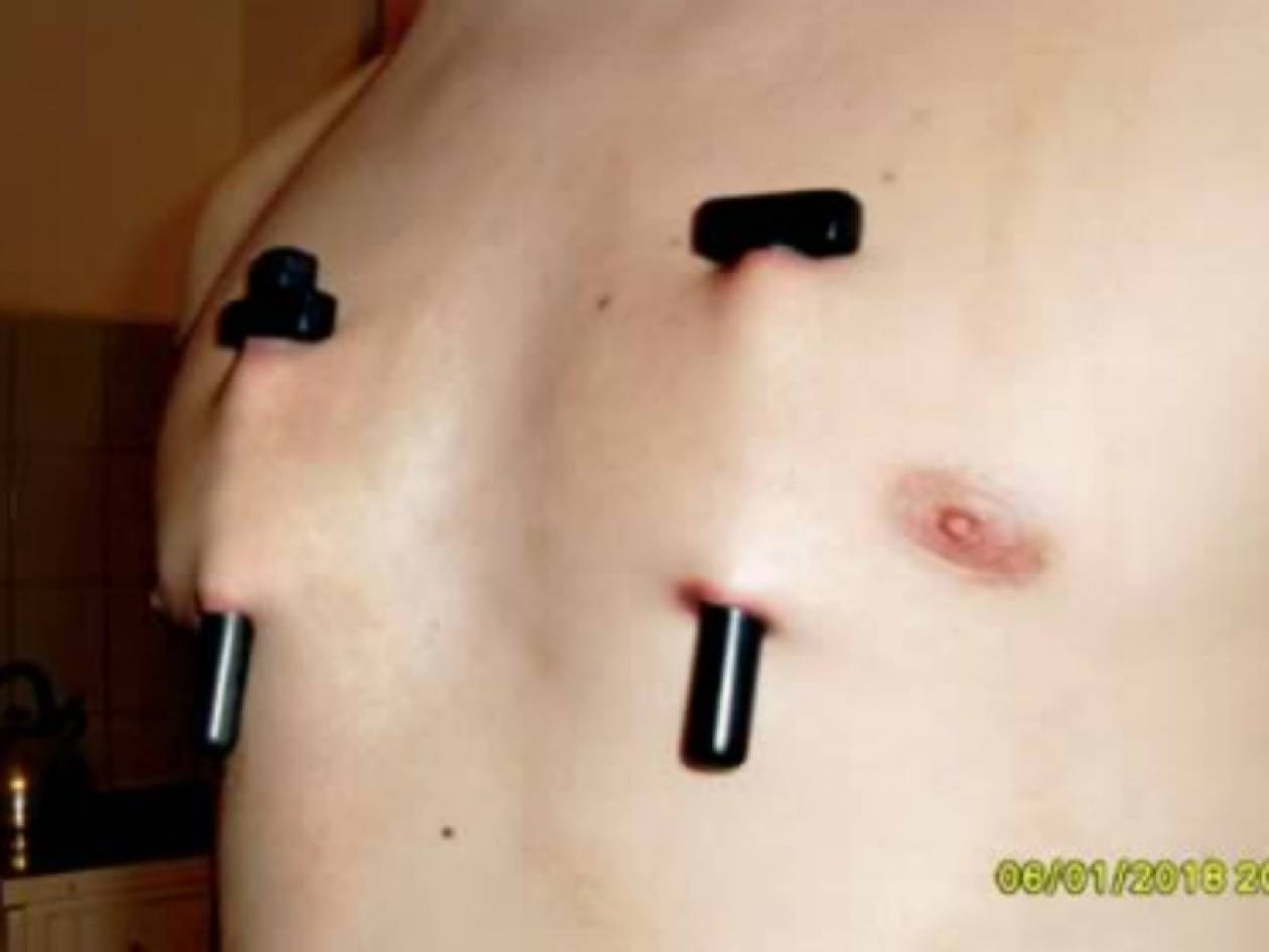 ΣΟΚ: Τα χειρότερα piercing σε ανθρώπινο σώμα.