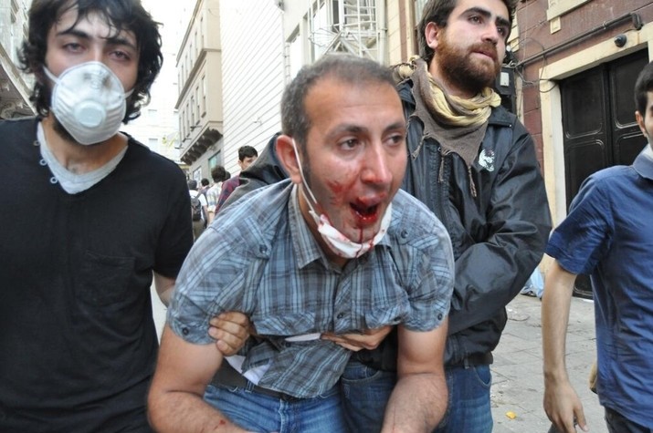 Συγκλονιστικές εικόνες στο twitter από τα επεισόδια στην Τουρκία