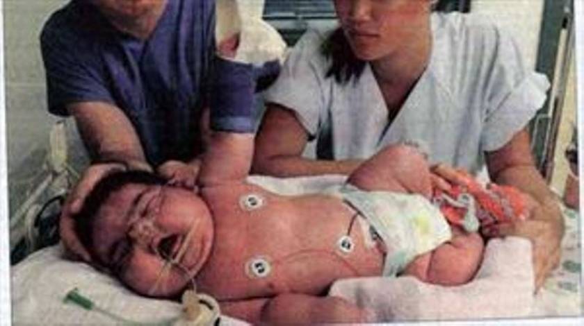 Δείτε το πιο βαρύ νεογέννητο στον κόσμο
