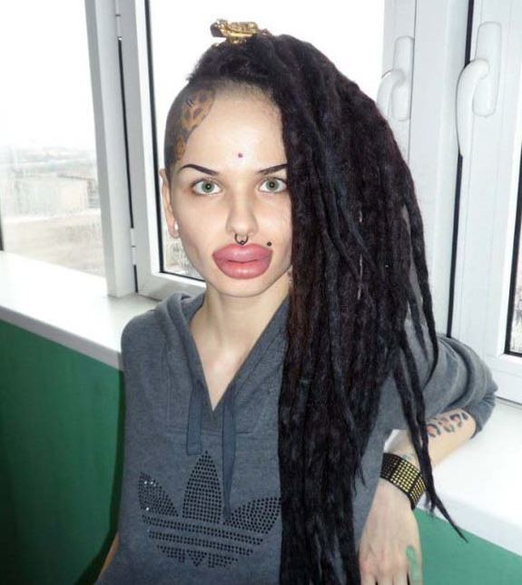 ΕΙΚΟΝΕΣ-ΣΟΚ:Η γυναίκα με τα μεγαλύτερα χείλη στον κόσμο