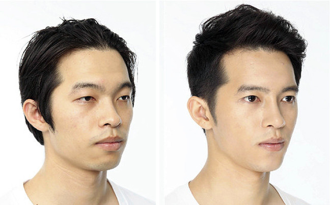 Κορεάτες πριν και μετά την πλαστική (pics)