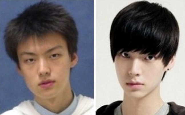 Κορεάτες πριν και μετά την πλαστική (pics)