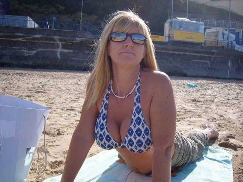 Βρετανία: Έσκασαν τα εμφυτεύματα σιλικόνης στο στήθος της! (photos)