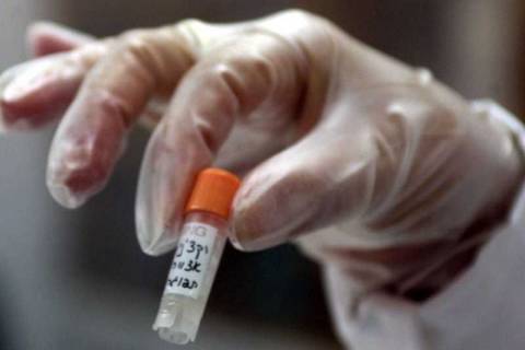 ΗΠΑ: Φιαλίδια με θανατηφόρο ιό βρέθηκαν ξεχασμένα σε εργαστήριο!