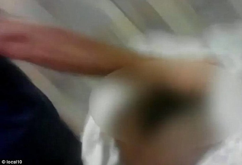 Νοσοκόμος επιτέθηκε σεξουαλικά σε αναίσθητο ασθενή (video)