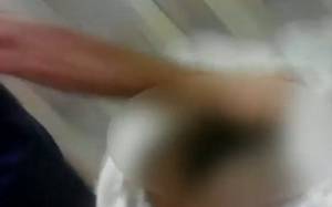 Νοσοκόμος παρενόχλησε σεξουαλικά αναίσθητο ασθενή (video)