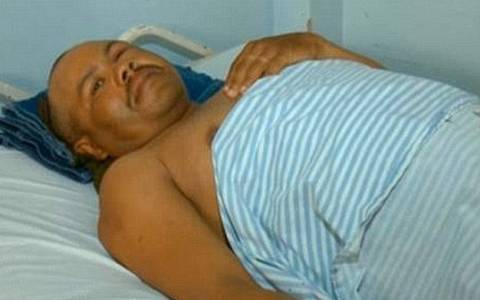 Μεξικό: Πήγε στα επείγοντα με καρφωμένο ένα ψαλίδι στο κεφάλι του (pics)
