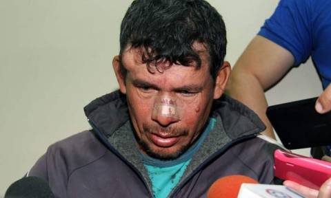 Παραγουάη: Συνελήφθη ο φερόμενος ως βιαστής της 10χρονης που έμεινε έγκυος