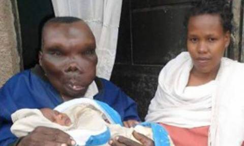O πιο άσχημος άνδρας της Ουγκάντα είναι περιζήτητος και έχει οκτώ παιδιά! (photos+videos)