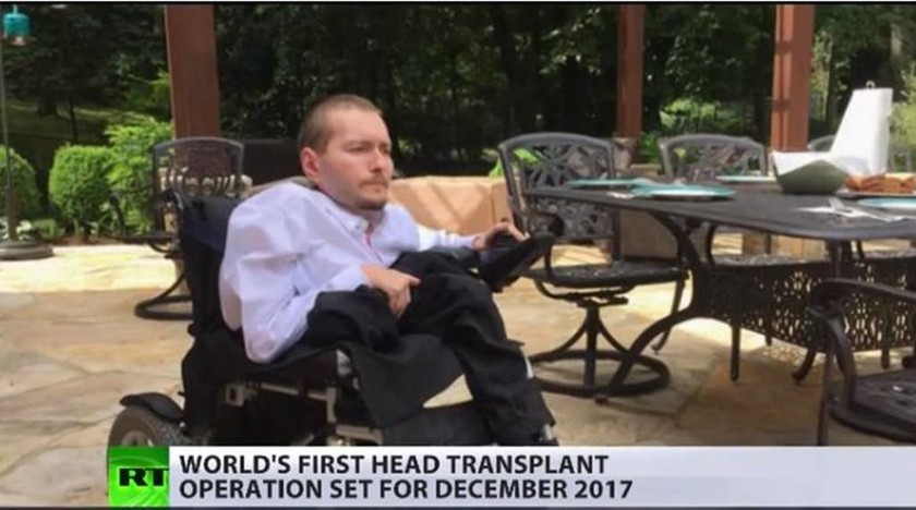 Στην Κίνα η πρώτη μεταμόσχευση… κεφαλιού σε άνθρωπο! (videos+photos)