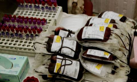 Εθελοντική αιμοδοσία στο ΑΠΘ στις 6 και 13 Οκτωβρίου