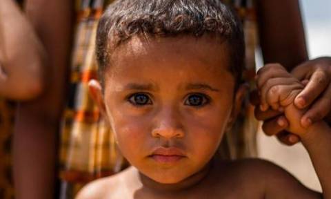Μισό εκατομμύριο παιδιά αντιμετωπίζουν οξύ υποσιτισμό στην Υεμένη