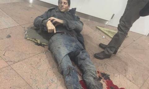 Εκρήξεις στο αεροδρόμιο των Βρυξελλών: Σοκ προκαλούν οι φωτογραφίες των τραυματιών (pics)