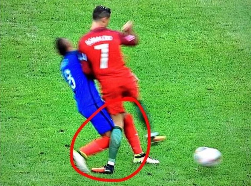 Τελικός Euro 2016: Σοκαριστικές φωτογραφίες από τον τραυματισμό του Ρονάλντο (pics)