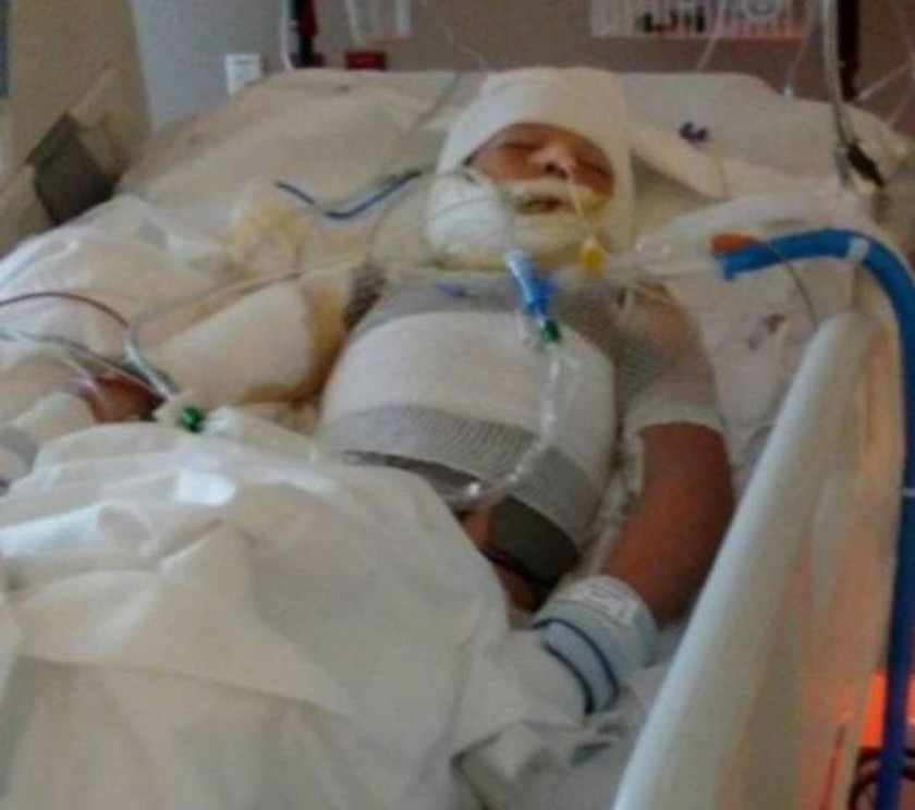 Φρίκη: Περιέλουσαν 10χρονο με βενζίνη και του έβαλαν φωτιά 