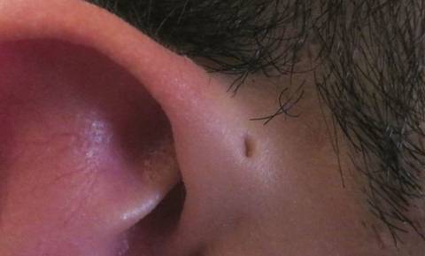 Εσύ ξέρεις τι σημαίνει αυτή η τρύπα στα αυτιά μερικών ανθρώπων; Μόλις μάθεις θα ανατριχιάσεις