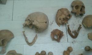 Θρίλερ με τον ανθρώπινο σκελετό που βρέθηκε στα Άνω Λιόσια - Αποκλειστικές φωτογραφίες