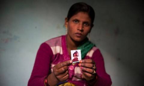 Σοκαριστικό: Επιτέθηκαν με οξύ σε 2χρονο αγόρι στην Ινδία (pics)
