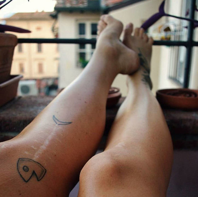 Viral: 30 εντυπωσιακά τατουάζ που μετατρέπουν τις ουλές σε έργα τέχνης