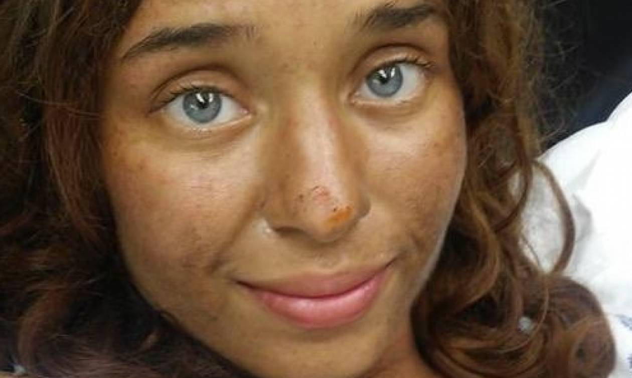 Γυναίκα βρέθηκε ζωντανή τέσσερις μήνες μετά την εξαφάνισή της – Πώς επιβίωσε μόνη στη ζούγκλα (pic)
