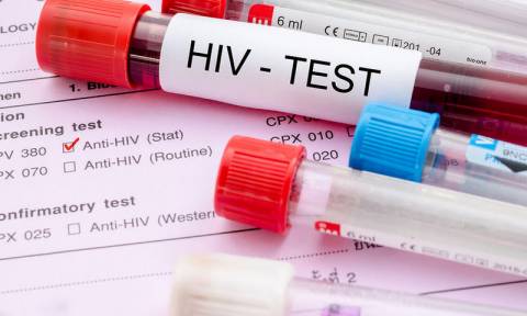 HIV - Aids: Με προσδοκίες το νέο πρόγραμμα δωρεάν γρήγορης και ανώνυμης εξέτασης