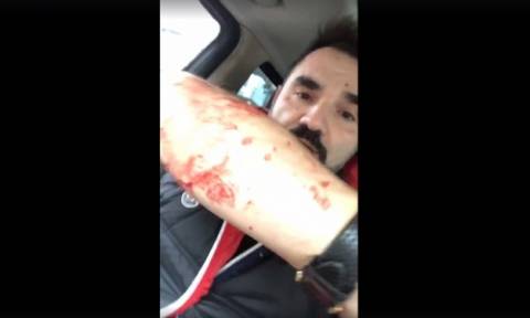Τι συμβαίνει με την υγεία του Νάσου Γουμενίδη μετά την άγρια επίθεση - Εικόνες σοκ από το νοσοκομείο
