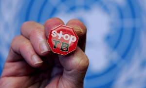 ΚΕΕΛΠΝΟ - ΕΚΠΑ: «Καμπανάκι» για τη φυματίωση – Παραμένει πρόβλημα δημόσιας υγείας