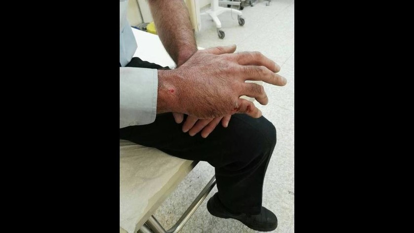 Αστυνομικοί με τραύματα σε κεφάλι και χέρι μετά από επίθεση Ρομά - Δείτε τις φωτογραφίες