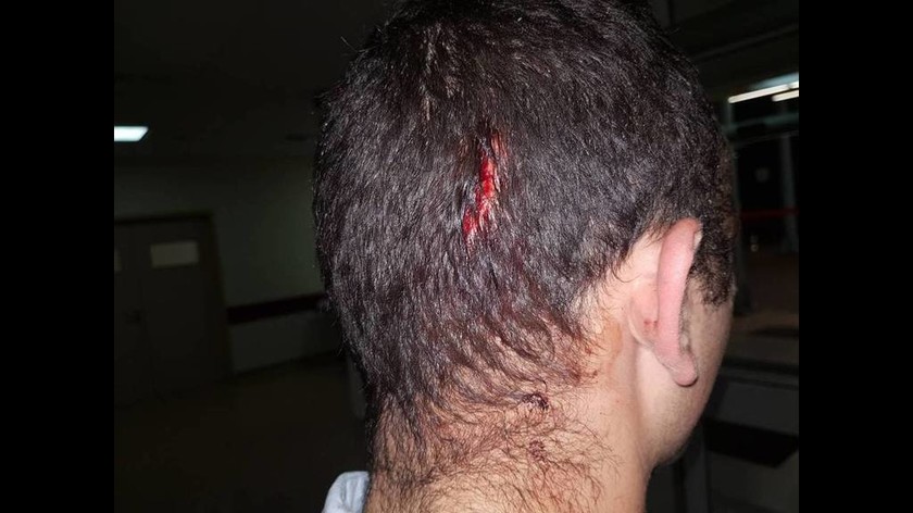 Αστυνομικοί με τραύματα σε κεφάλι και χέρι μετά από επίθεση Ρομά - Δείτε τις φωτογραφίες
