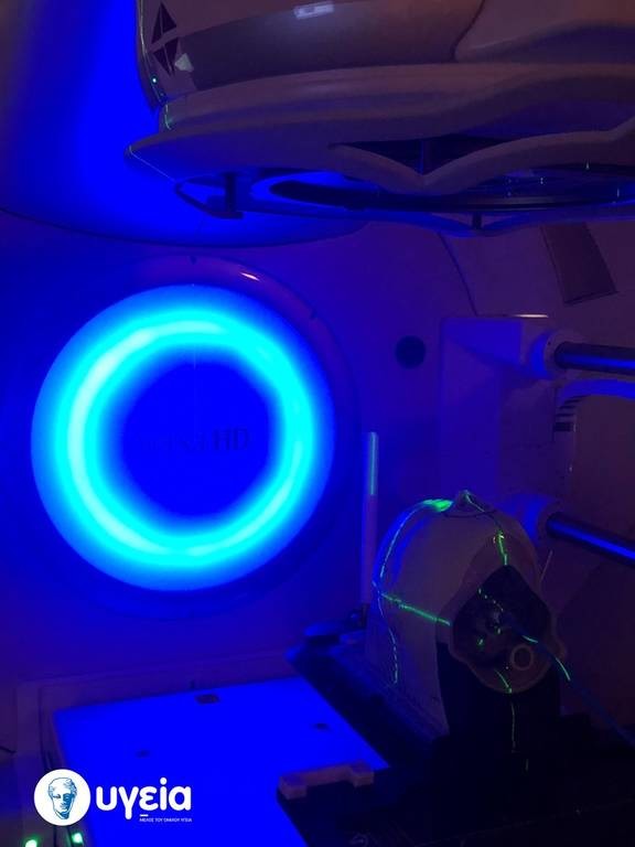 ΥΓΕΙΑ: Νέα μέθοδος για μέγιστη ακρίβεια στην ακτινοθεραπεία του εγκεφάλου 