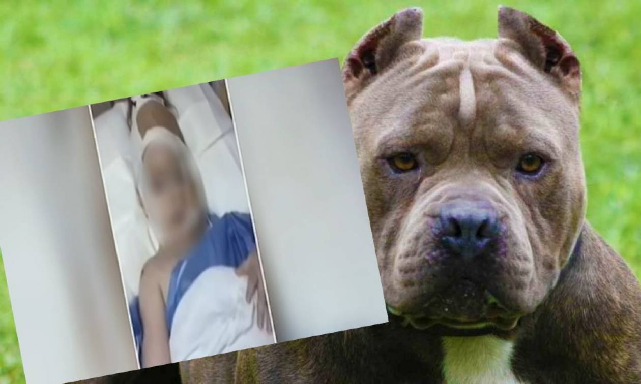 Επίθεση σκύλου σε κοριτσάκι 3 ετών: Η ζωοφιλία του χαβαλέ οδηγεί σε δράματα