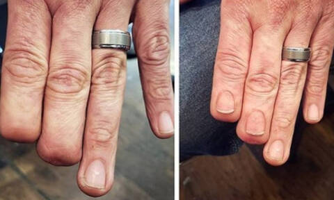 Δείτε πώς η δύναμη του τατουάζ έδωσε πίσω τα δάχτυλα σε έναν άνθρωπο! 