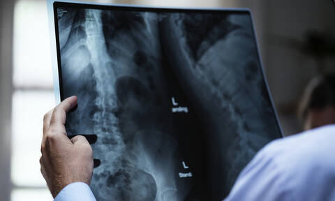 Στο νοσοκομείο με αφόρητους πόνους: «Κάγκελο» με αυτά που βρήκαν στο στομάχι του οι γιατροί