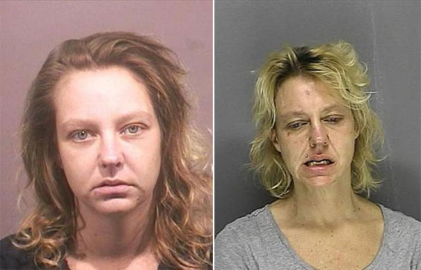 Σοκαριστικές φωτογραφίες ανθρώπων πριν και μετά την χρήση ναρκωτικών  