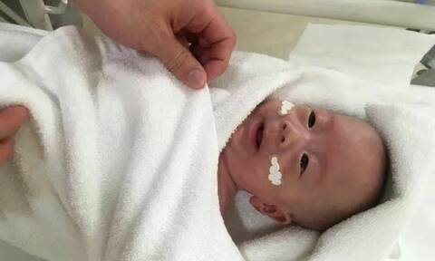 «Θαύμα»: Γεννήθηκε μόλις 258 γραμμάρια και κατάφερε να ζήσει! (pics)