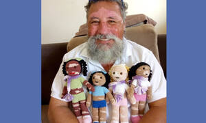 Παππούς που πάσχει από λεύκη δημιουργεί τις πιο εντυπωσιακές κούκλες για ομοιοπαθή παιδιά (pics)