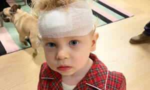 Έξι ράμματα στο κεφάλι για τον γιο της μετά από ατύχημα μέσα στο σπίτι! (photos)