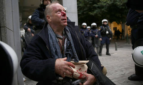 Επεισόδια στο κέντρο της Αθήνας: Ξυλοκόπησαν δημοσιογράφο στο Σύνταγμα (pics&vid)
