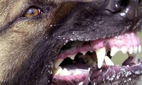 ΣΟΚ: Άγρια επίθεση σκύλου σε 7χρονο αγοράκι μπροστά στα μάτια του πατέρα του (pics)