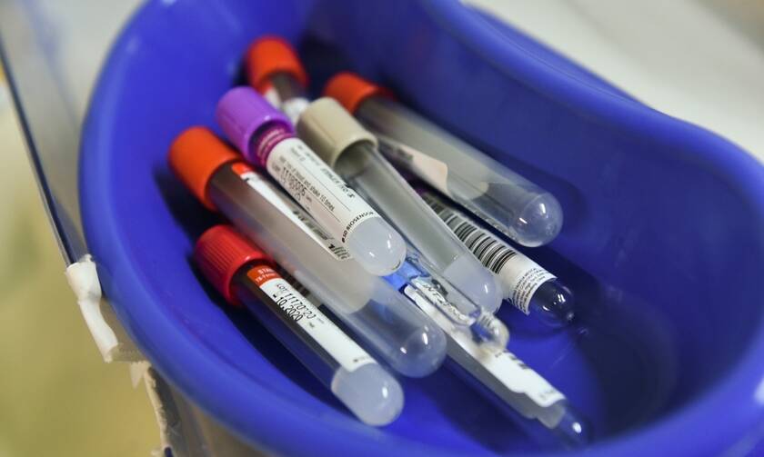 Κορονοϊός: ΕΟΔΥ και ΕΚΠΑ ενισχύουν την εργαστηριακή διερεύνηση του ιού - Ανάγκη για περισσότερα τεστ