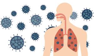 Κορονοϊός: Γιατί κινδυνεύουν περισσότερο όσοι έχουν άσθμα