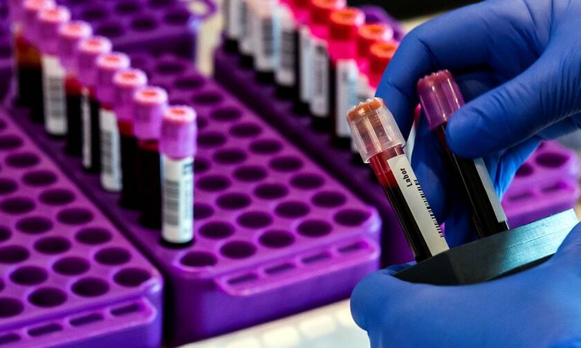 Κορονοϊός: Πιθανή θεραπεία από πλάσμα αίματος με αντισώματα ερευνά συμμαχία επιστημονικών ομάδων