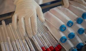 Κορονοϊός: Αυτά είναι τα φάρμακα που προστατεύουν από τον φονικό ιό - Ελπίδες από νέα μελέτη
