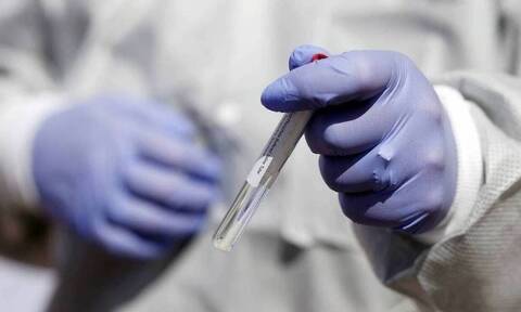Κορονοϊός: Αμερικανικό εμβόλιο θα δοκιμαστεί σε 30.000 εθελοντές από τον Ιούλιο 
