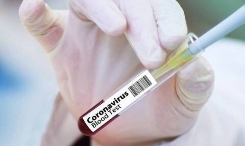 Κορονοϊός - Αναστολή δοκιμών εμβολίου AstraZeneca: Ο Νίκος Σύψας εξηγεί τι συνέβη