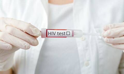Εμπόδια στην πρόσβαση των απαραίτητων εξετάσεων για όσους ζουν με HIV