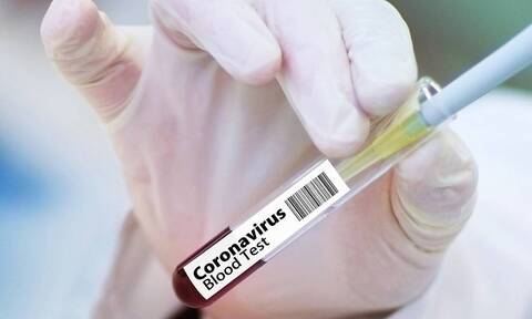 Κορονοϊός: Ξανάρχισε η δοκιμή του πειραματικού εμβολίου της AstraZeneca 