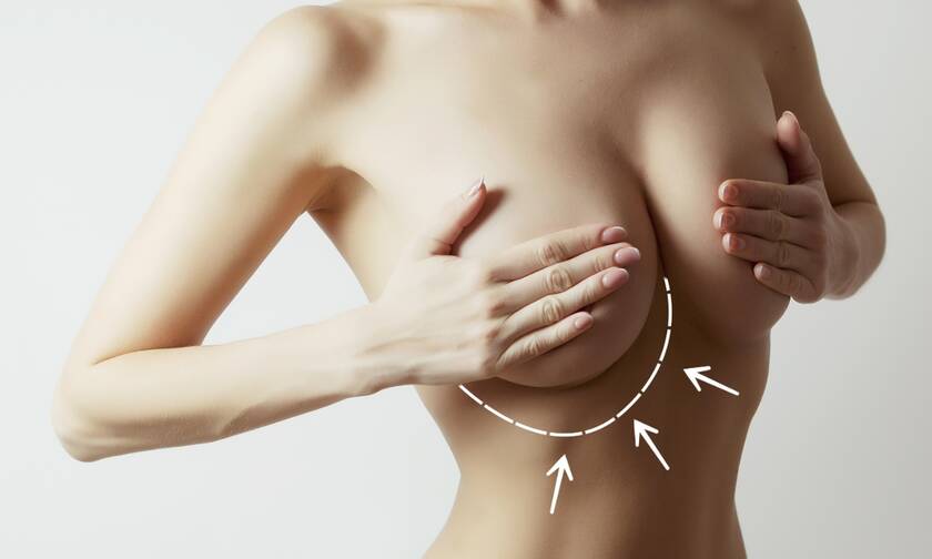 Φλεγμονώδης καρκίνος του μαστού: 6 συμπτώματα σε εικόνες